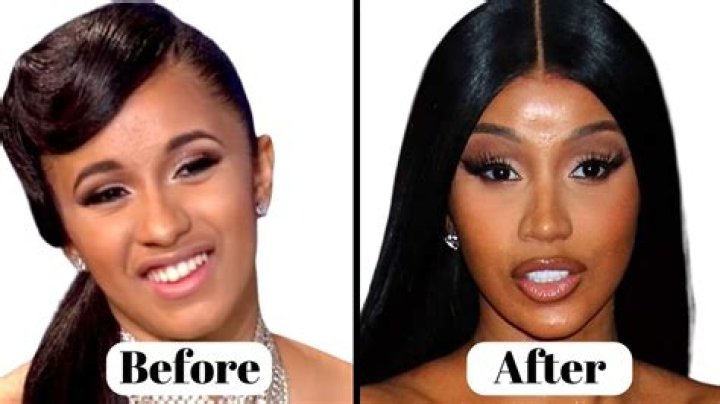 Alondradessy Before BBL: Plastic Surgery Transformation