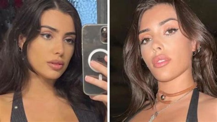 Ashley Leechin Before Surgery: How Did She Look Previously?