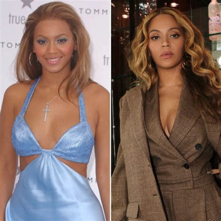 Did Beyonce Get A BBL? Before And After Photos