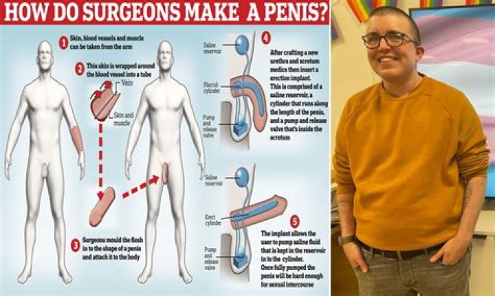 Fatboy SSE Surgery: Wife Exposed Him For Getting Penile Enlargement Surgery