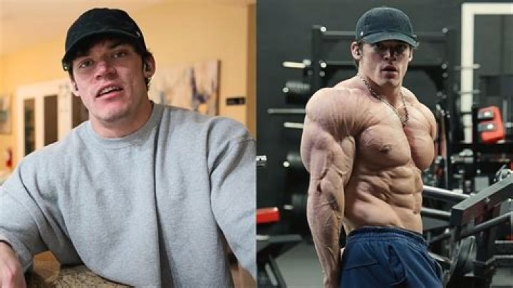 Is Sam Sulek Autistic? Health Update 2023