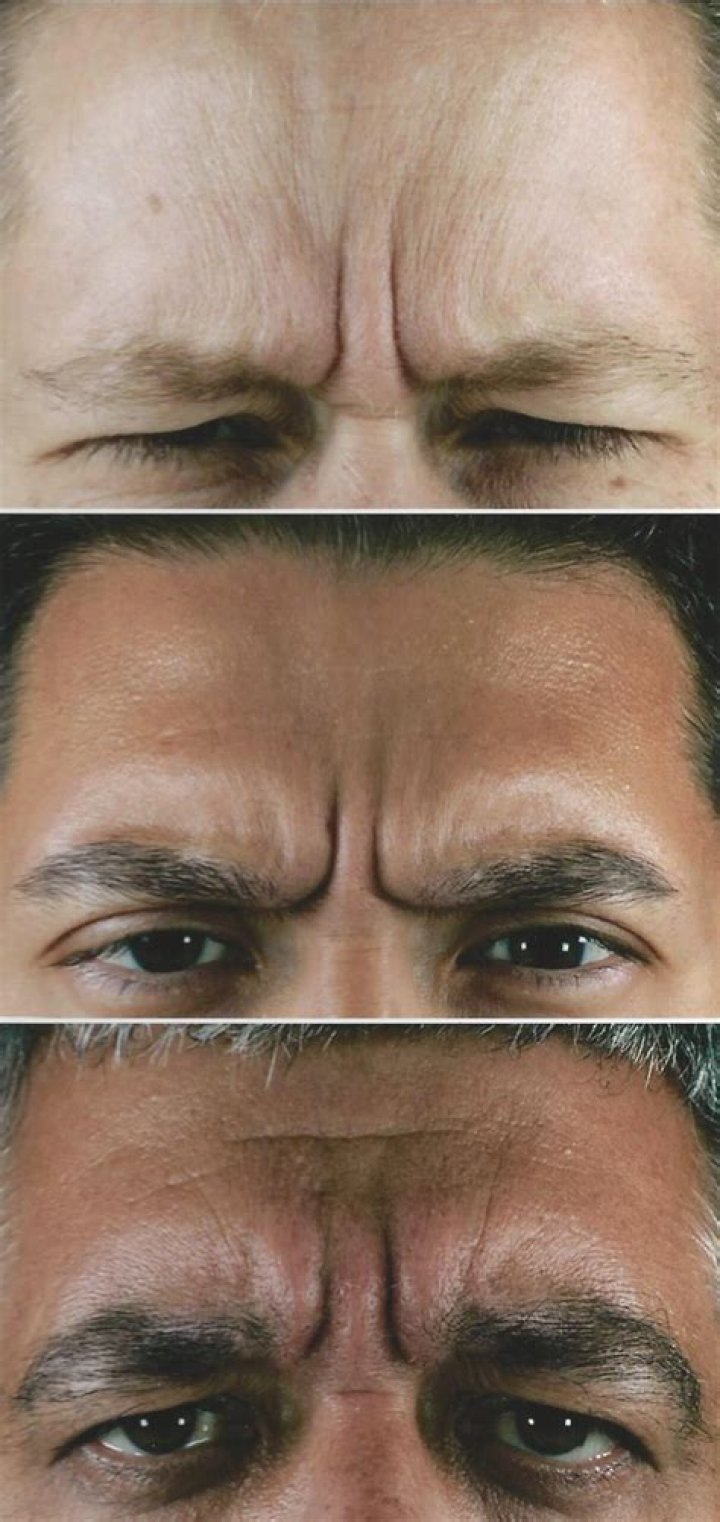 What Happened To Joshua Dobbs Eyebrows? Medical Condition And Disease