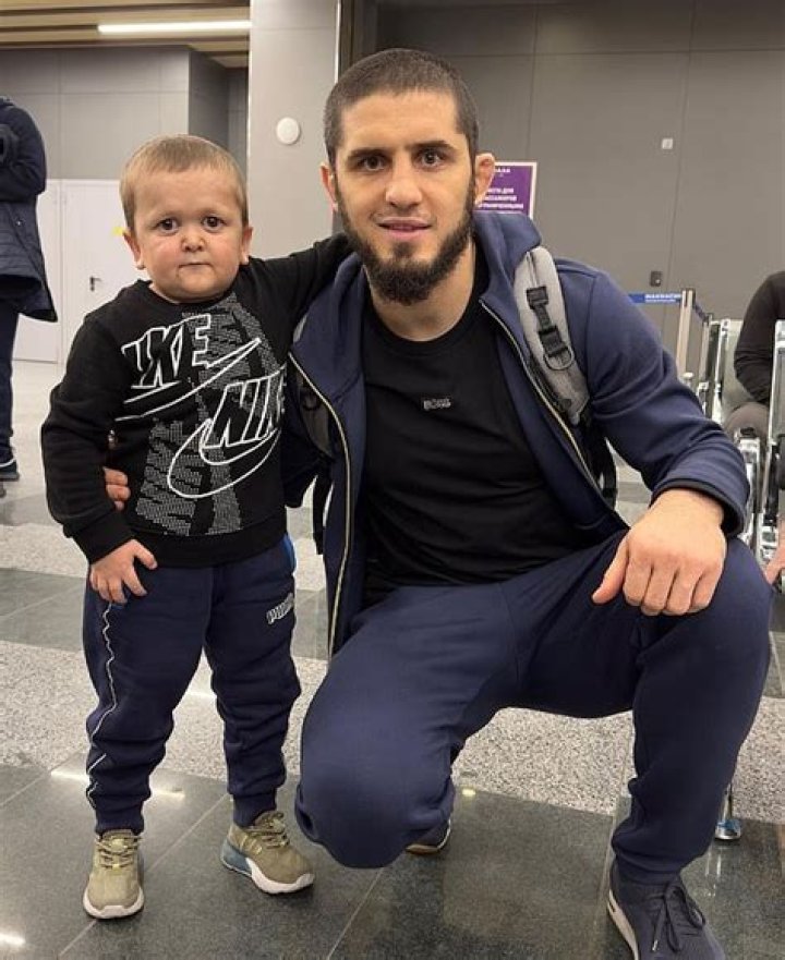 Who Is Aminat Magomedov, Hasbulla Twin Sister? Disease And Boyfriend