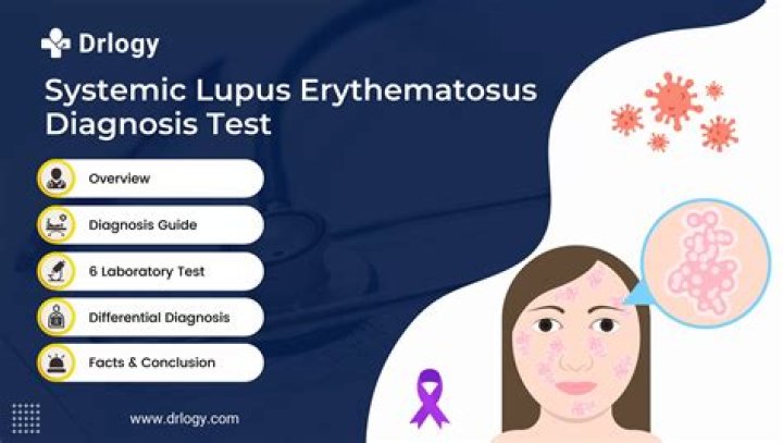Zhou Hai Mei Death: Lupus Erythematosus Diagnosis